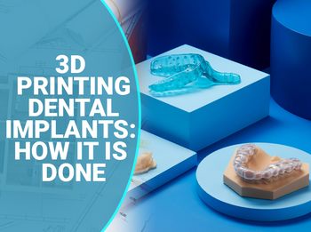 3D Printing Dental Implants-How It Is Done