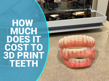 How Much Does it Cost to 3D Print Teeth?